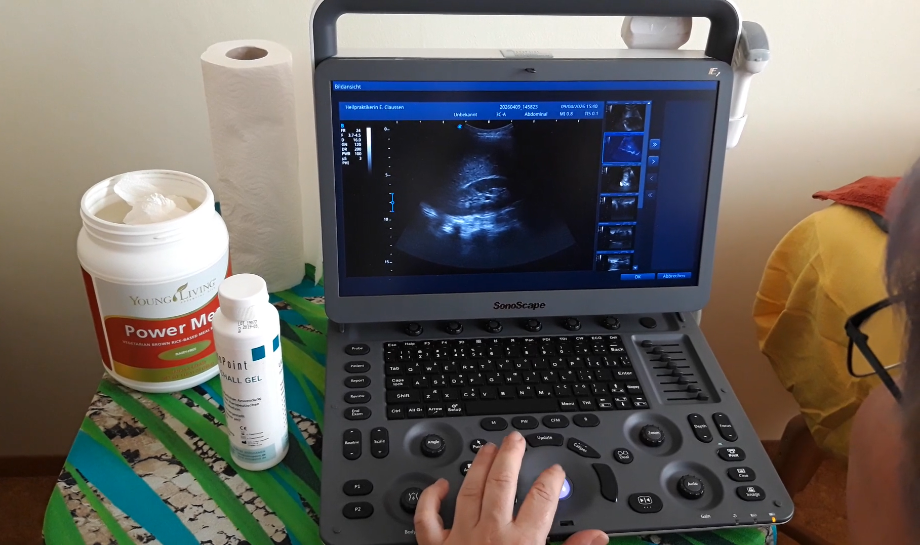 Gesundheitsdiagnostik - Krebs-Präventionsdiagnostik